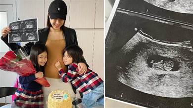 鐘嘉欣38歲生日宣布「三胎」喜訊，一對子女抱媽媽肚子聽胎心溫馨有愛，身材依然纖細苗條：女神范十足