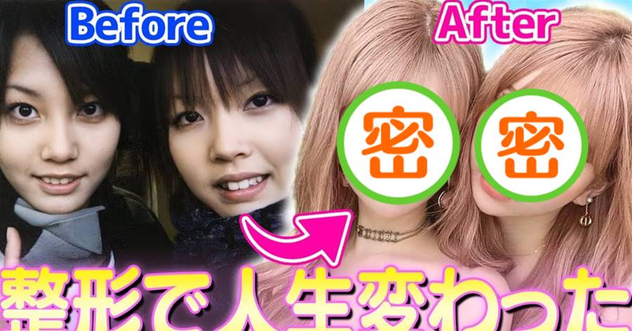 只為比對方更美！日本雙胞胎姐妹砸千萬整容，做超痛手術驚呆網友：根本是換臉