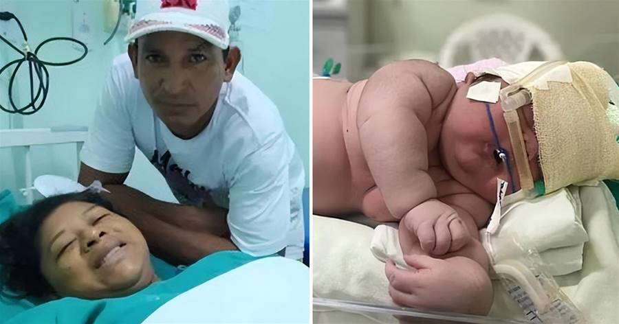巴西女子產下巨嬰！剛出生「7.3公斤」體長59厘米，直接穿1歲娃的衣服
