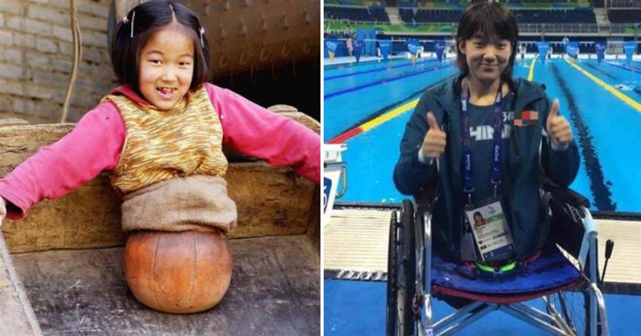 20年前那個失去雙腿「用籃球走路」的女孩，現狀令人驚訝，她的經歷無法想象